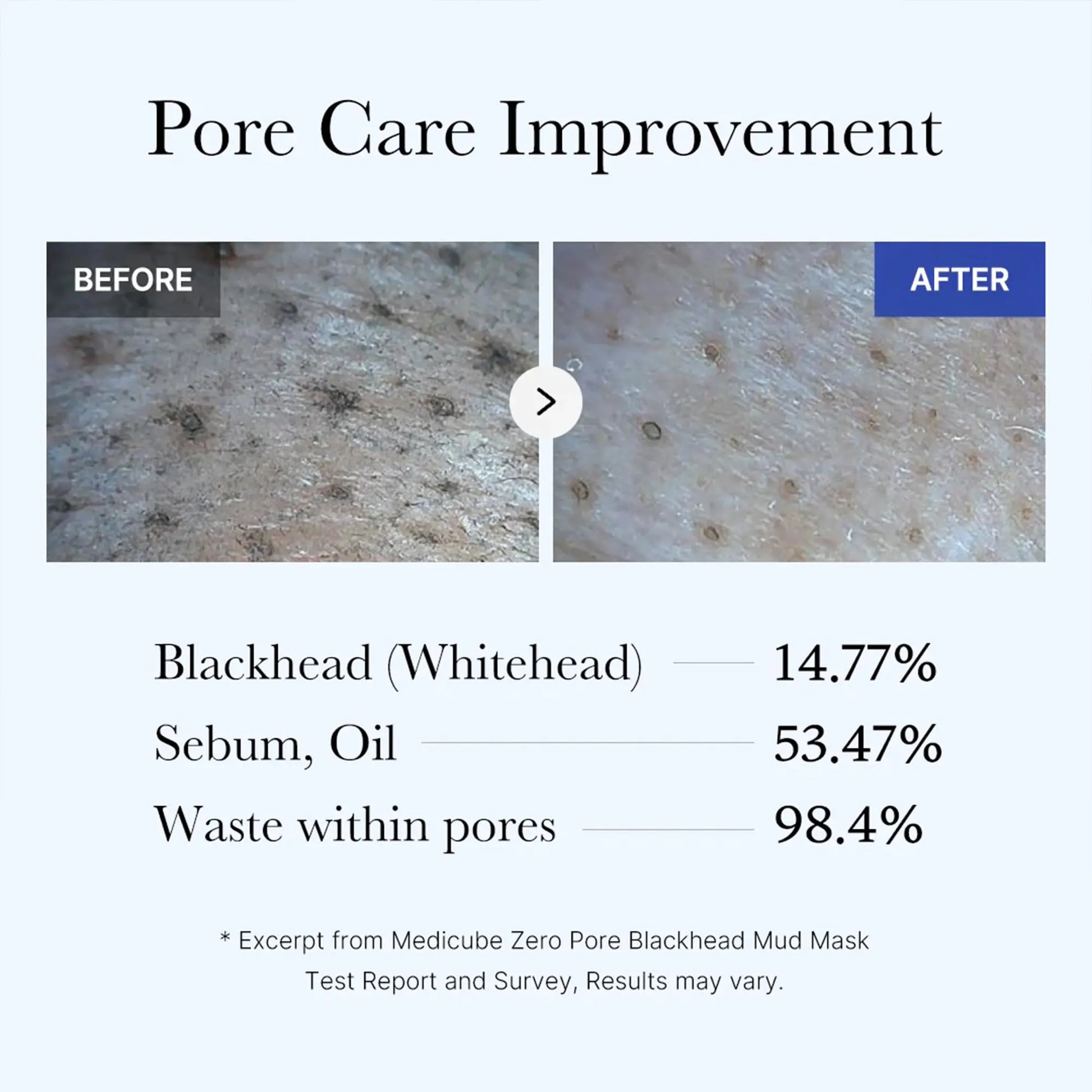 Medicube Zero Pore Blackhead Mud Facial Mask - Skin Cooling & Pore Tightening - 3 Minute Quick Dry Formula with AHA, BHA, PHA, and Pore-Purifying Clay - Korean Mud Mask 3.52 oz
